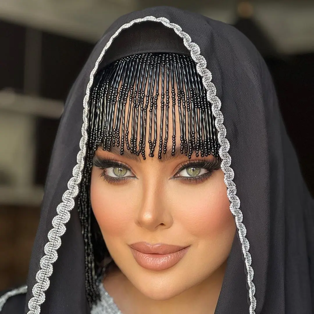آلارز