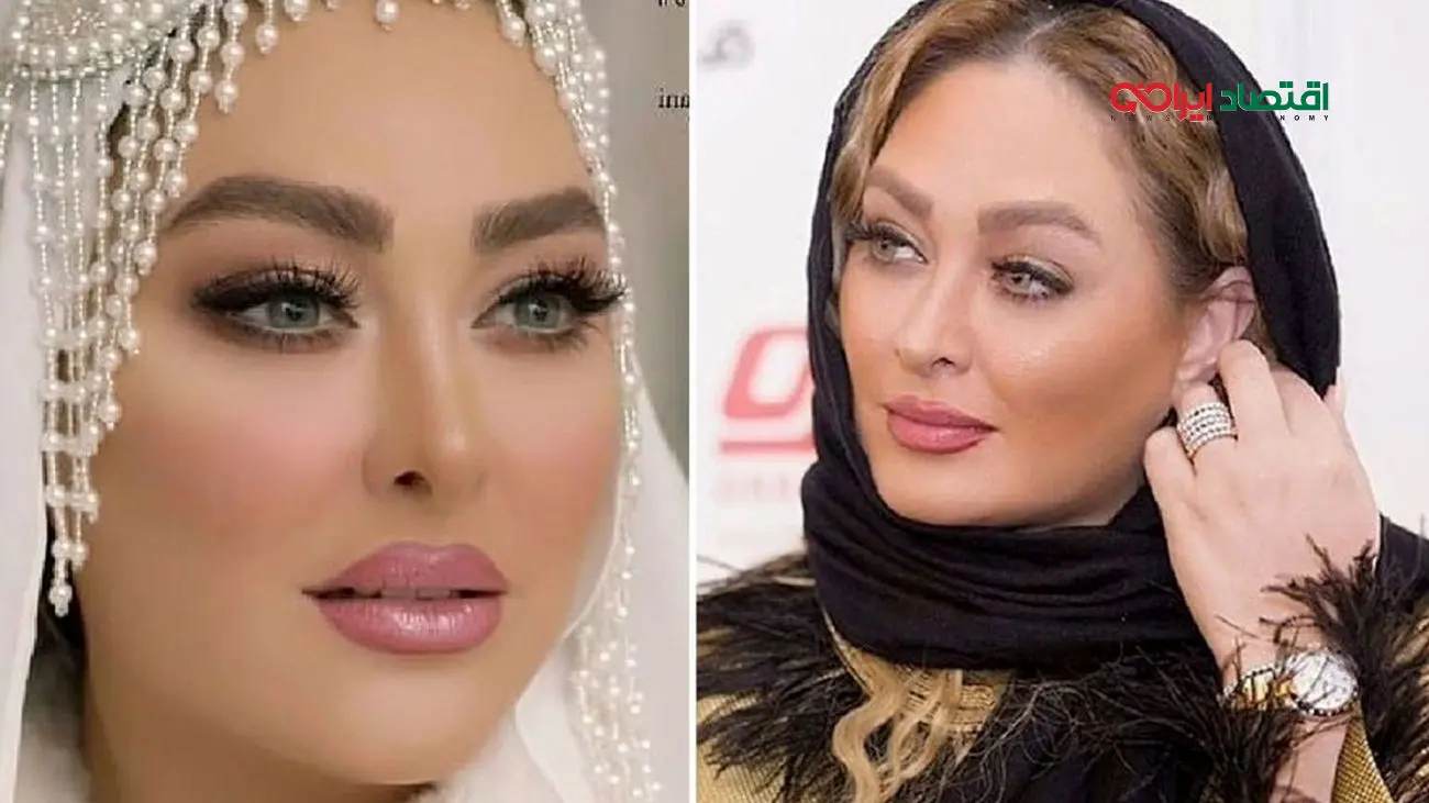 تزریقها و بوتاکسهای الهام حمیدی؛ راز زیبایی چهره او فاش شد!