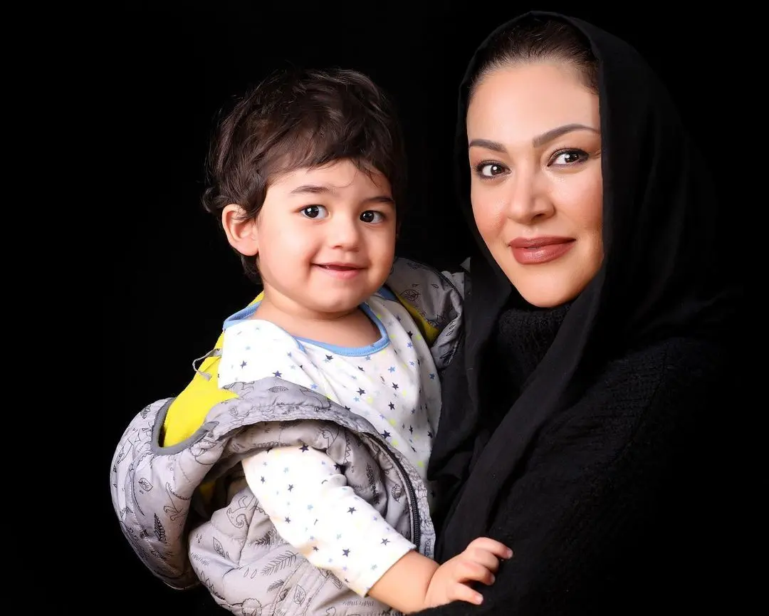 اولین عمل زیبایی زیبا بروفه بعد از جوانمرگی شوهرش ! + عکس باورنکردنی