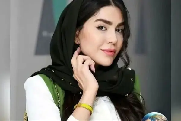 شوکه‌کننده! تغییر باورنکردنی چهره آزاده زارعی، بازیگر محبوب سریال «آوای باران»