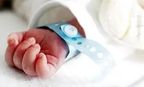 عکس تولد نوزاد عجیب‌الخلقه با چهره فوق ترسناک / مادرش تا دید سکته کرد !