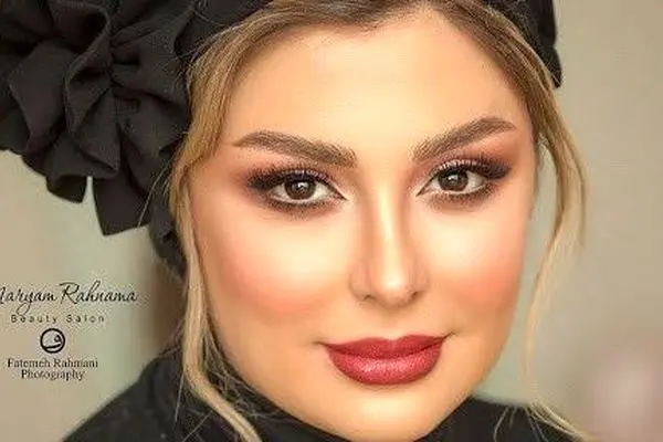 تغییر چهره عجیب نیوشا ضیغمی؛ بازیگری که همه را شوکه کرد!