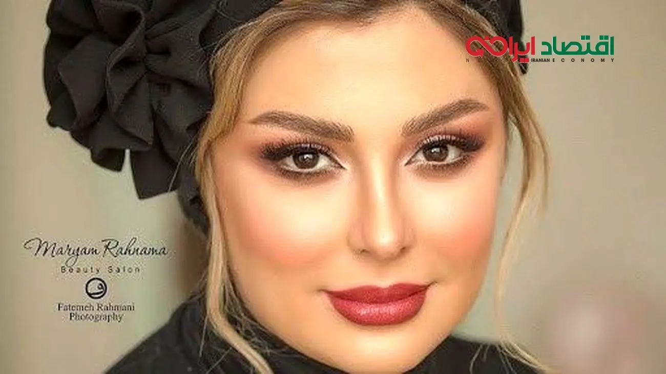 تغییر چهره عجیب نیوشا ضیغمی؛ بازیگری که همه را شوکه کرد!