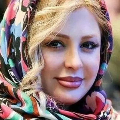 افشاگری نیوشا ضیغمی درباره مشکل تنفسی و عمل سنگین بینی‌اش