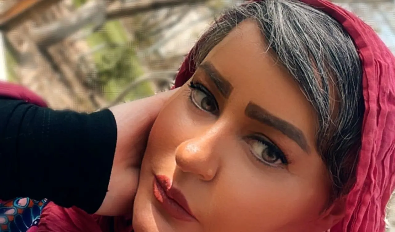 عکس شوکه کننده از چهره جدید نعیمه نظام دوست / خانم بازیگر را دیگر نمی شناسید !