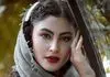 مریم مومن قبل و بعد جراحی / داستان تکان‌دهنده زیبایی تا خوشبختی!