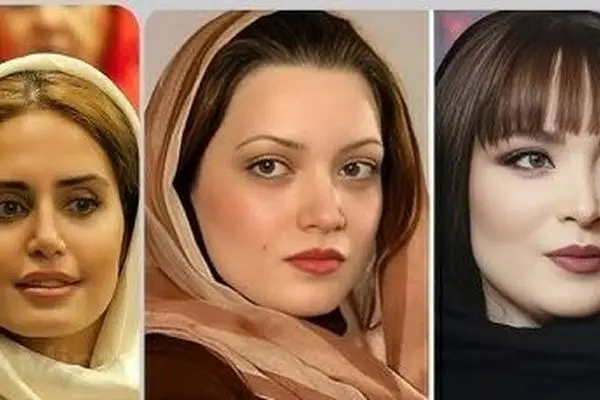 چهره باورنکردنی بازیگران زن بعد از عمل زیبایی؛ سحر دولتشاهی تا نیوشا ضیغمی بی‌نظیر شدند!
