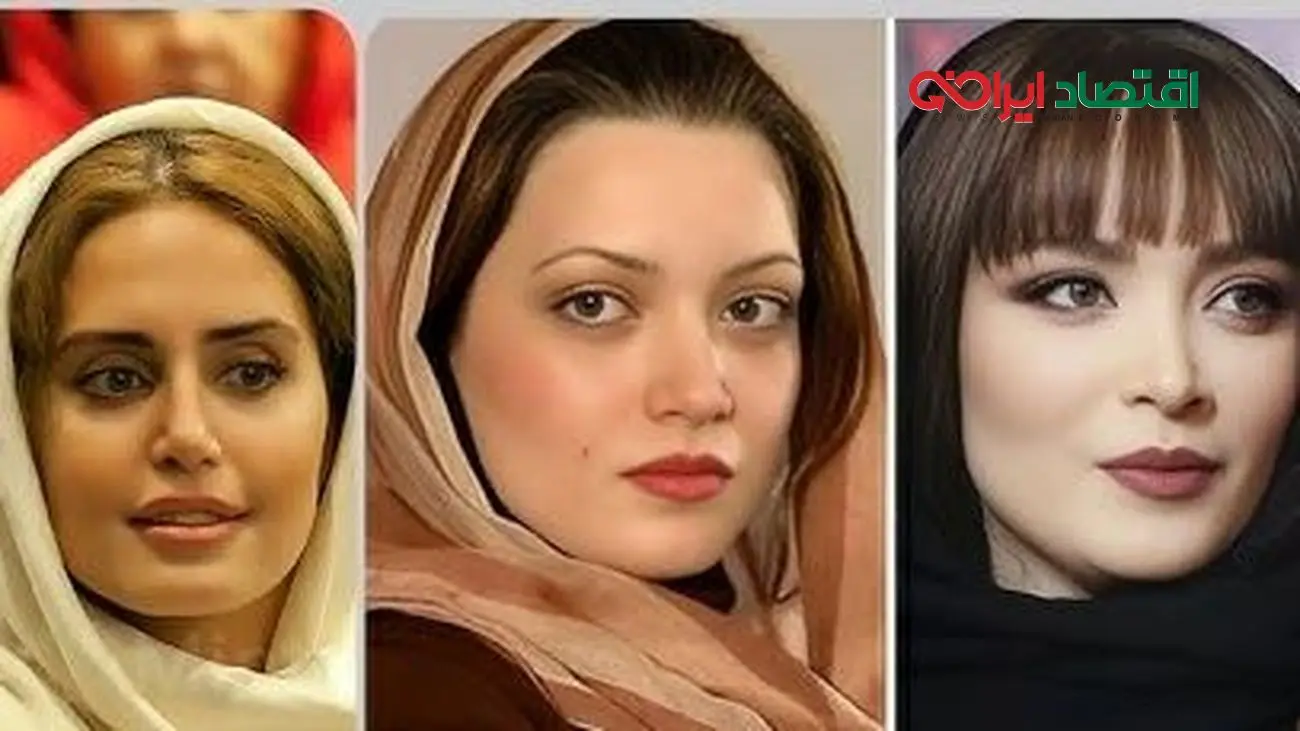 چهره باورنکردنی بازیگران زن بعد از عمل زیبایی؛ سحر دولتشاهی تا نیوشا ضیغمی بی‌نظیر شدند!