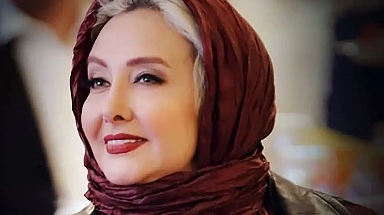 عکس های باورنکردنی از تغییر چهره جنجالی خانم بازیگران ایرانی / قبل عمل زیبایی چی بودند !