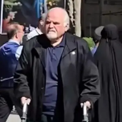 عکس عجیب از تغییر چهره دایی یونسِ محبوب «پس از باران» که همه را غافلگیر کرد!