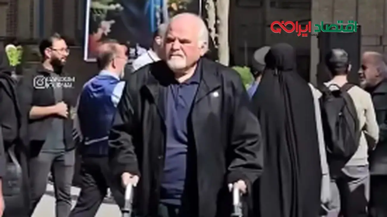 عکس عجیب از تغییر چهره دایی یونسِ محبوب «پس از باران» که همه را غافلگیر کرد!