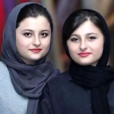 جراحی نیکای محبوب سریال پایتخت: تغییرات شگفت‌انگیز چهره‌اش!