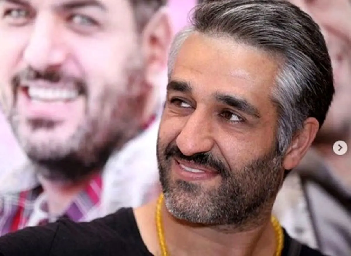 فیلم باورنکردنی از تغییر چهره پژمان جمشیدی / چه بلایی سر این مرد آمد ؟!