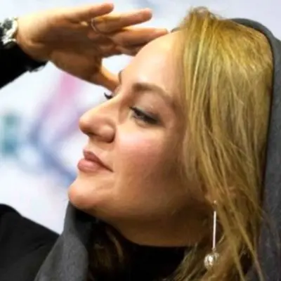 چهره غیرمنتظره مهناز افشار در دوران حاملگی! +عکس