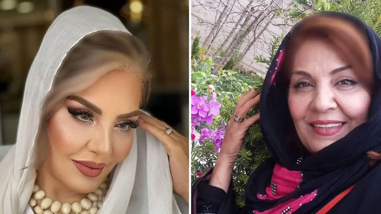 تلخ ترین عکس از زهره حمیدی بعد از شیمی درمانی / خانم بازیگر درگیر سرطان شد !