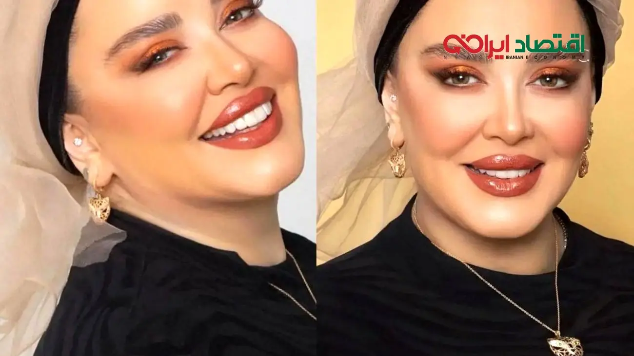 عکس جنجالی از تغییر چهره بهاره رهنما با جدیدترین عمل زیبایی