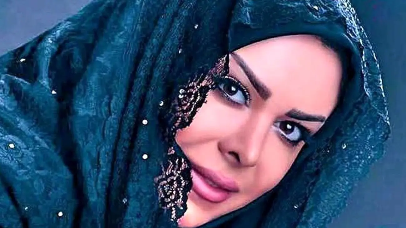 جدیدترین عکس از فلور نظری با تزریق زیبایی و ژل / 20 سال جوانتر شده !