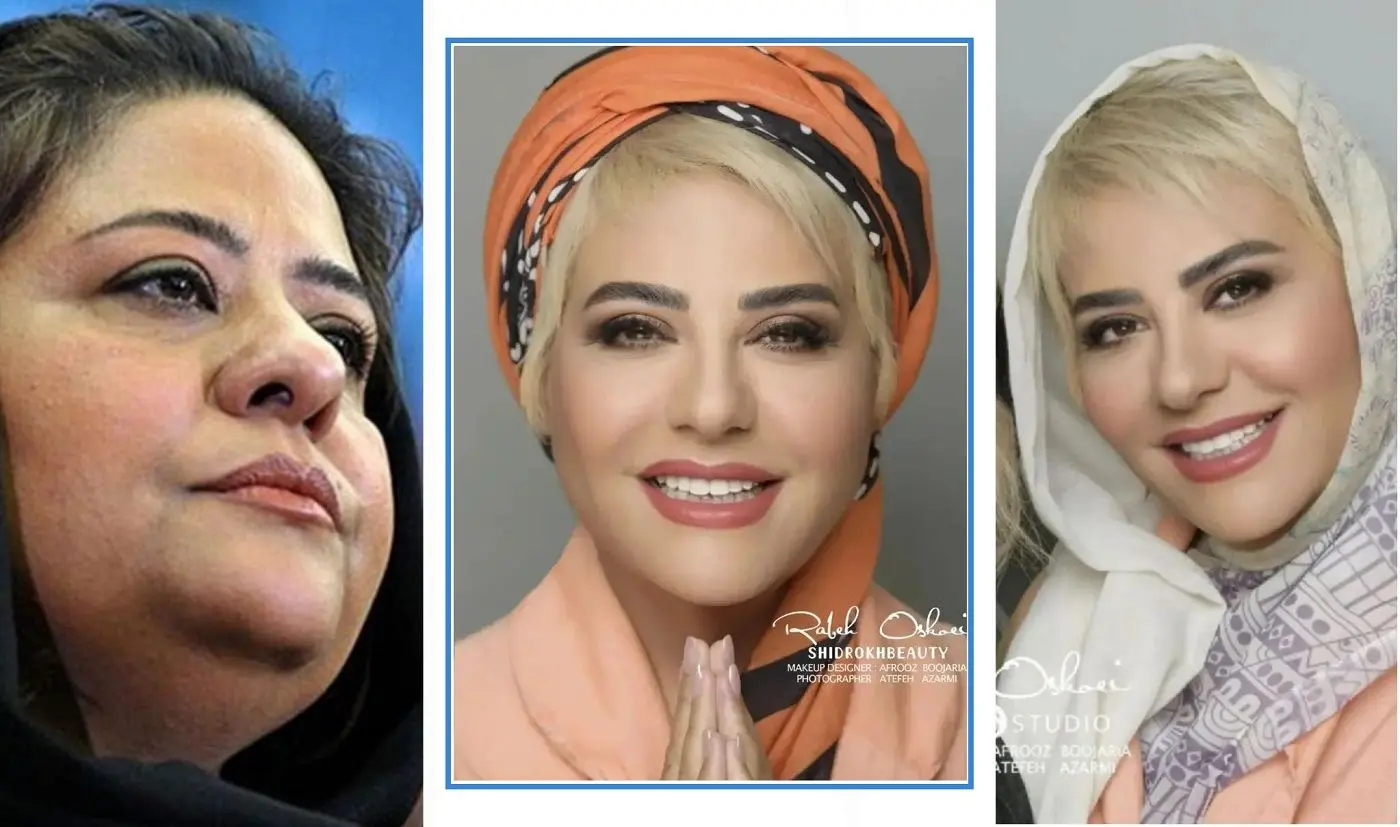 تغییر چهره رابعه اسکویی بعد از لاغری جنجالی / باربی ایران مدل هالیوودی شد !