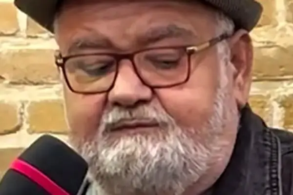 اکبر عبدی سکته مغزی کرد!