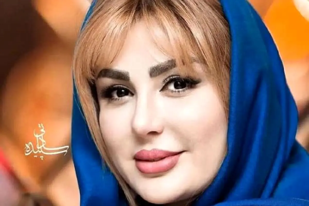 6 عکس از زیبایی طبیعی خانم بازیگران ایرانی قبل از عمل زیبایی