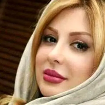 تغییر غیرمنتظره نیوشا ضیغمی پس از شیمی درمانی؛ چهره‌ای که دیگر قابل شناسایی نیست!