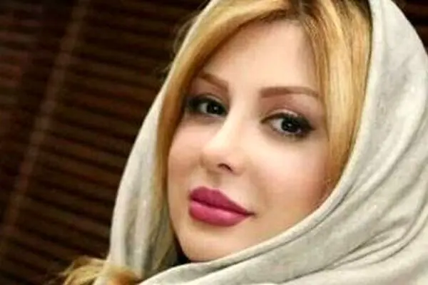 تغییر غیرمنتظره نیوشا ضیغمی پس از شیمی درمانی؛ چهره‌ای که دیگر قابل شناسایی نیست!