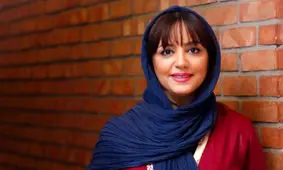  تغییر چهره عروسکی خانم بازیگر سریال خواب و بیدار/ از چهره زشت تا مدلینگی !