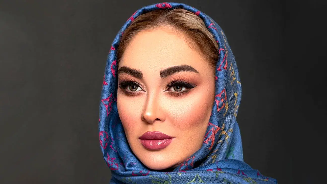 تغییر چهره خیلی متفاوت الهام حمیدی بعد از عمل زیبایی / این اون نیست ! + عکس ها