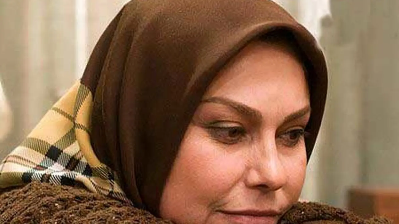 عکس چهره باورنکردنی از قبل و بعد عمل خانم بازیگران ایرانی !