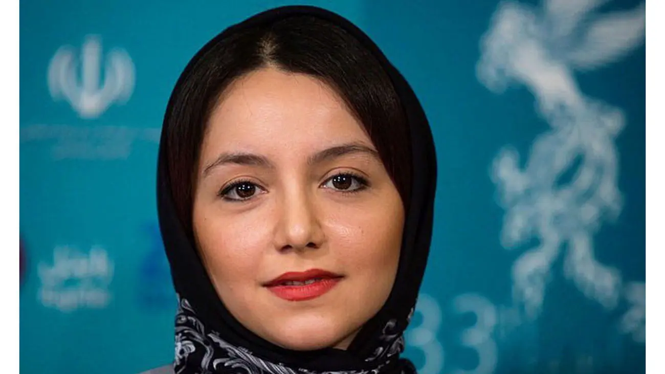 تغییر چهره وحشتناک نازنین بیاتی بعد عمل زیبایی / حیف چهره این ملوس !