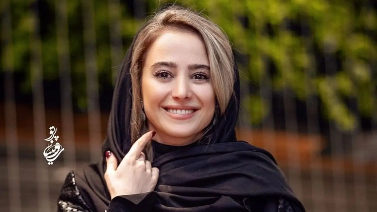 تغییر چهره شوکه کننده الناز حبیبی بعد از عمل زیبایی / جاسوئیچی واقعا جذاب شد !