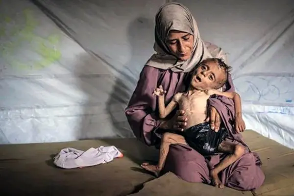 بحران گرسنگی در غزه: مرگ پیوسته کودکان در سکوت جهانی