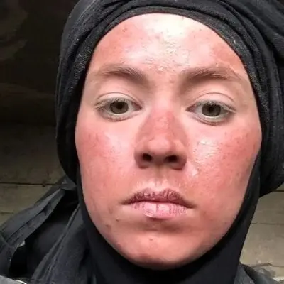 تصاویر شوکه‌کننده از تغییر چهره نیلوفر رجایی‌فر بعد از سریال پایتخت!