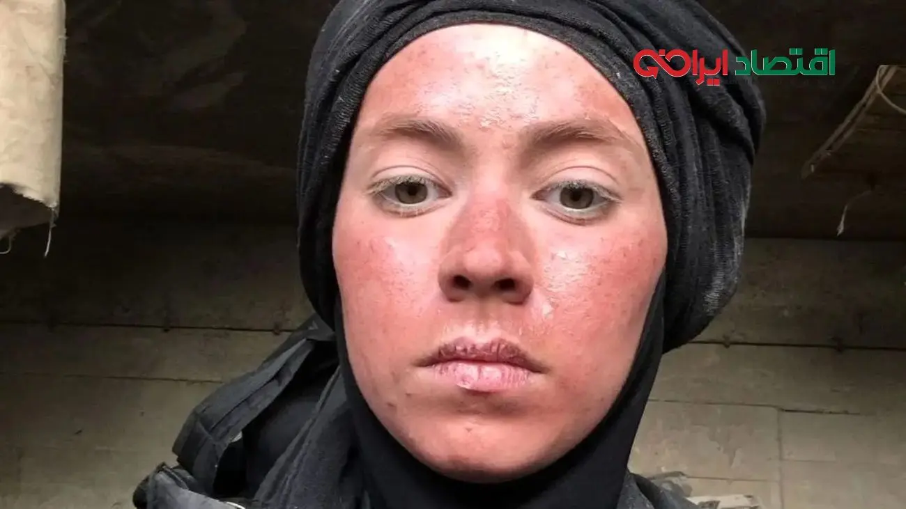 تصاویر شوکه‌کننده از تغییر چهره نیلوفر رجایی‌فر بعد از سریال پایتخت!