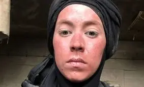 تصاویر شوکه‌کننده از تغییر چهره نیلوفر رجایی‌فر بعد از سریال پایتخت!