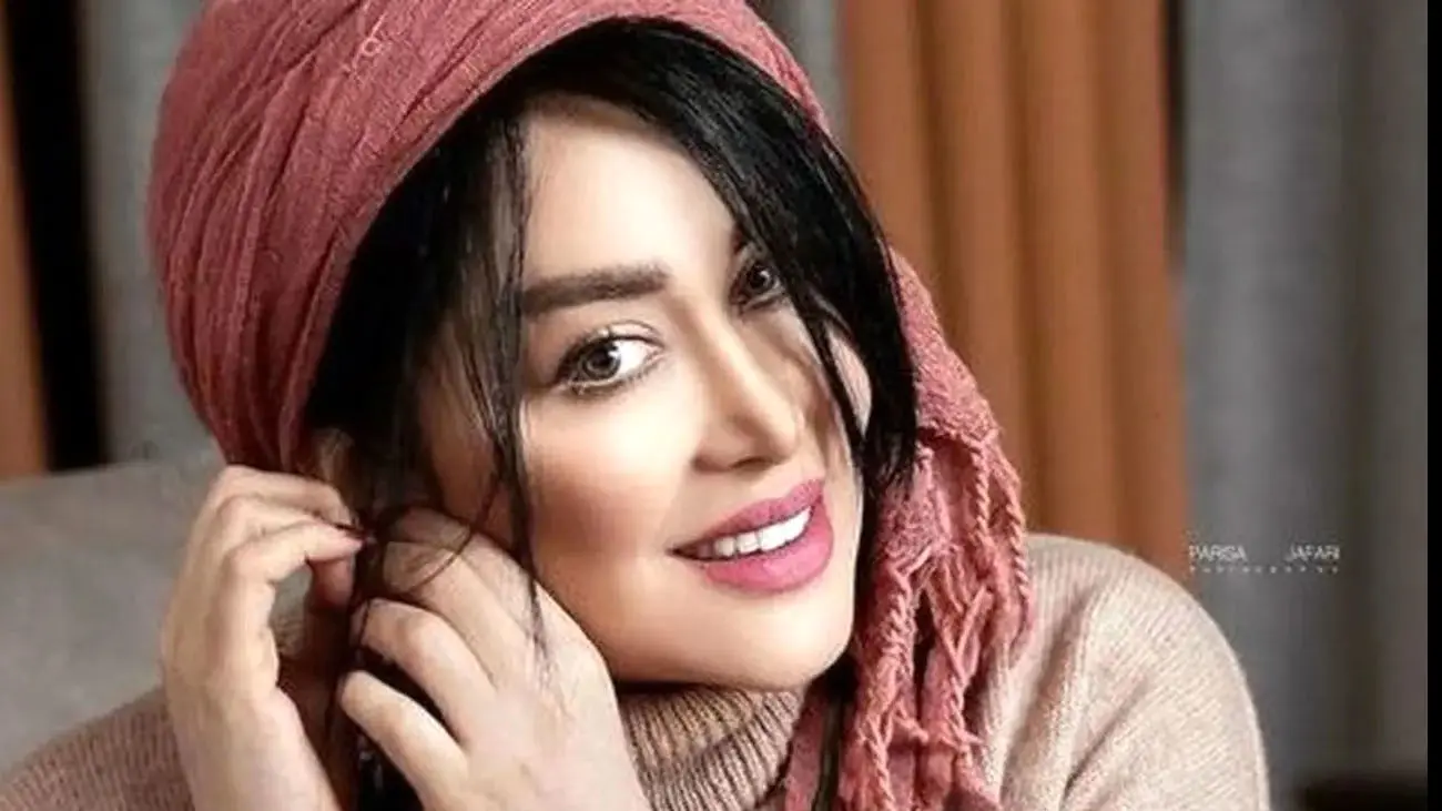 جنجال تغییر چهره سارا منجزی پور با جدیدترین عمل زیبایی / اصلا نمی شناسیدش !