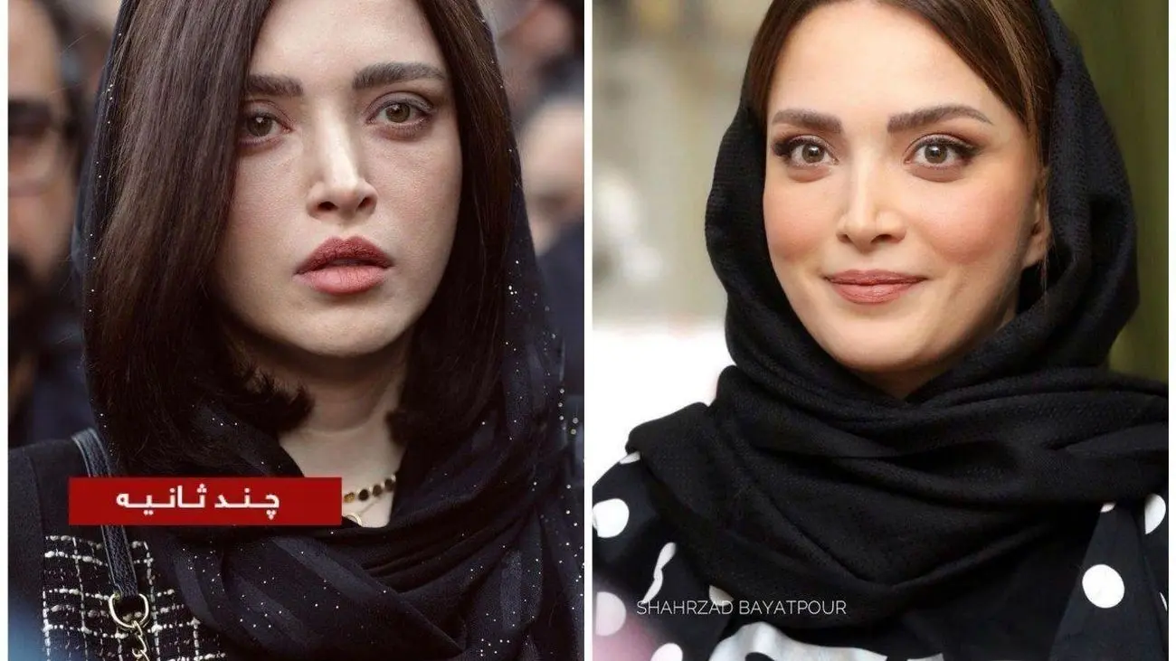 بهنوش طباطبایی عمل سانترال لب انجام داده است؟
