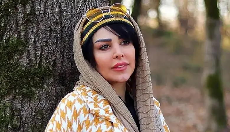 فلور نظری تبدیل به عروسک شد !+ عکس صورت مصنوعی در این سن و سال !