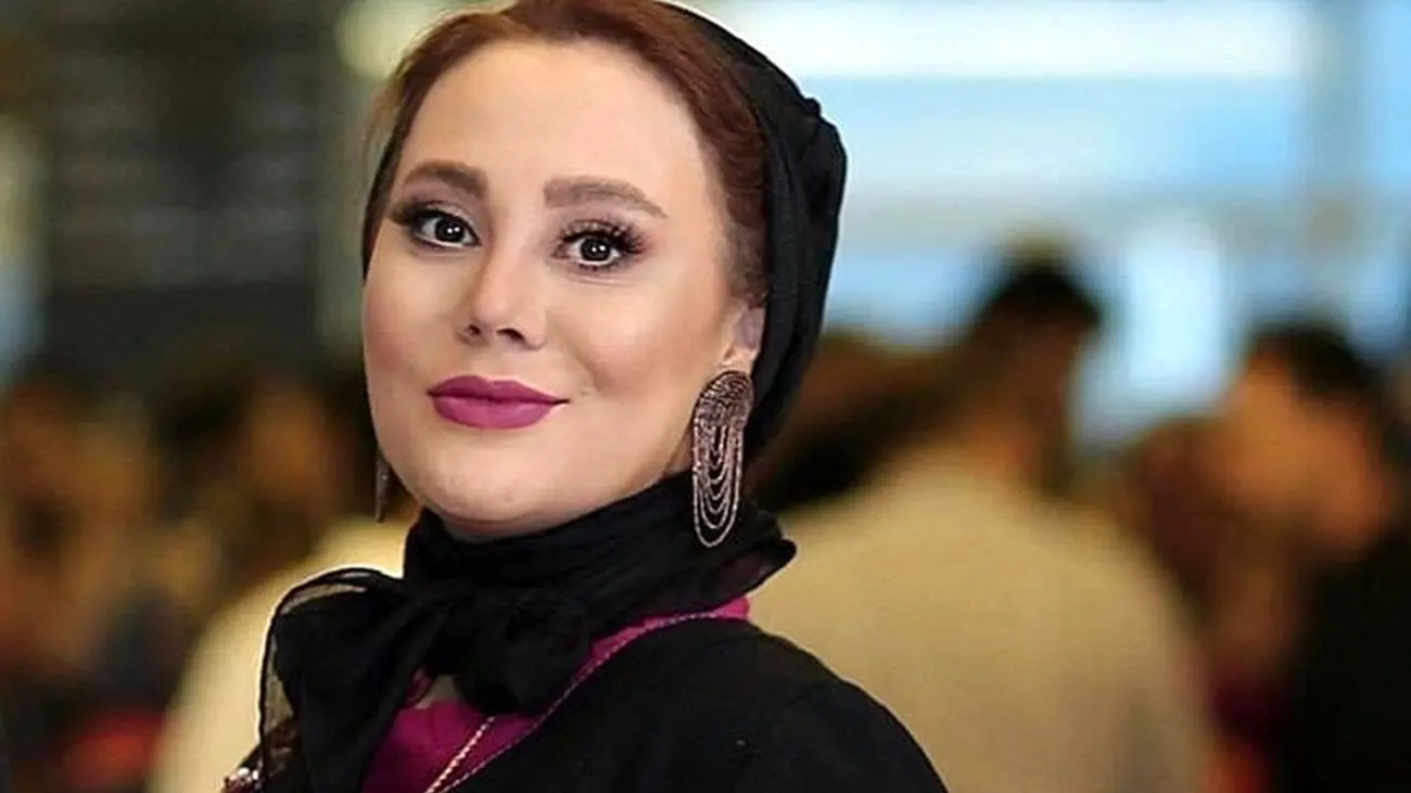 تغییر چهره جنجالی آرام جعفری بعد از عملهای زیبایی + فیلم شوکه کننده از قبل و بعد