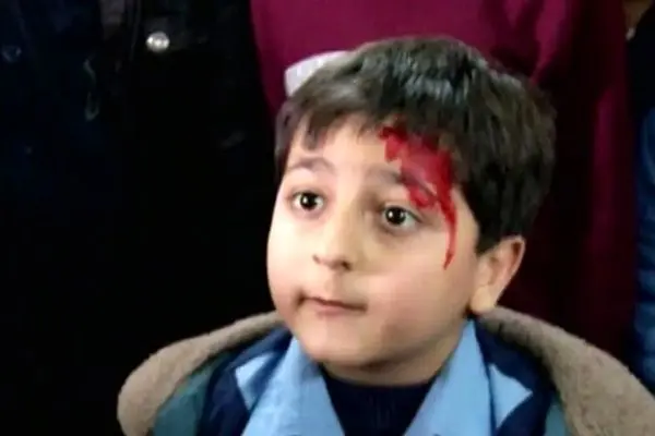 ماجرای جالب محمدرضا شیرخانلو: عاشق سینما شدم و فیزیوتراپی نرفتم!