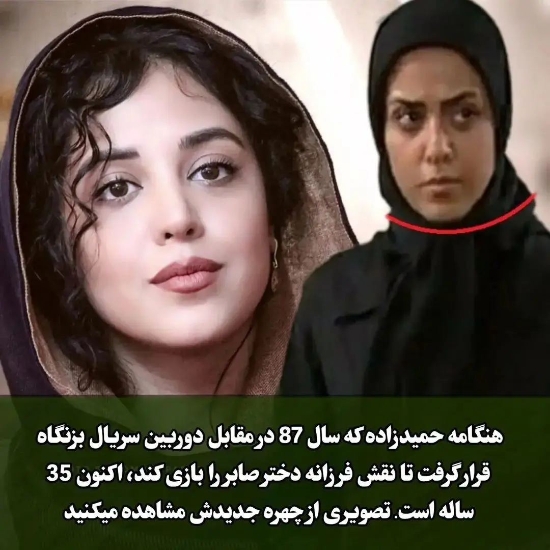 تغییر چهره ۲ خواهر سریال بزنگاه بعد از 16 سال