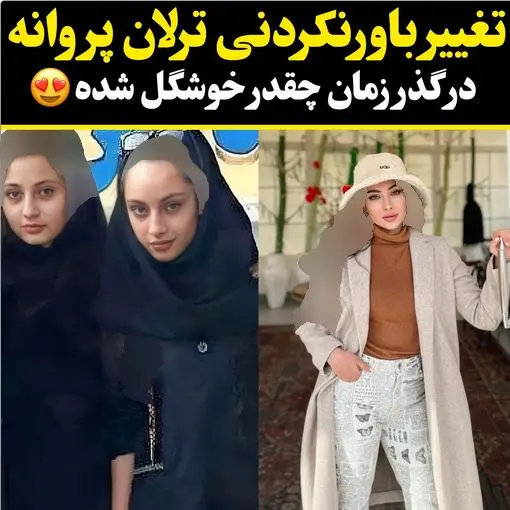 ترلان پروانه