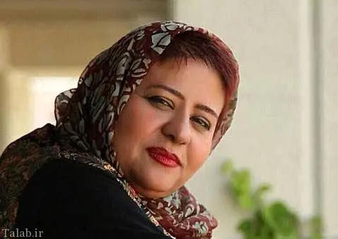 زشت ترین عکس از چهره رابعه اسکویی 18 سال پیش ! / خانم بازیگر زیر و رو شد !