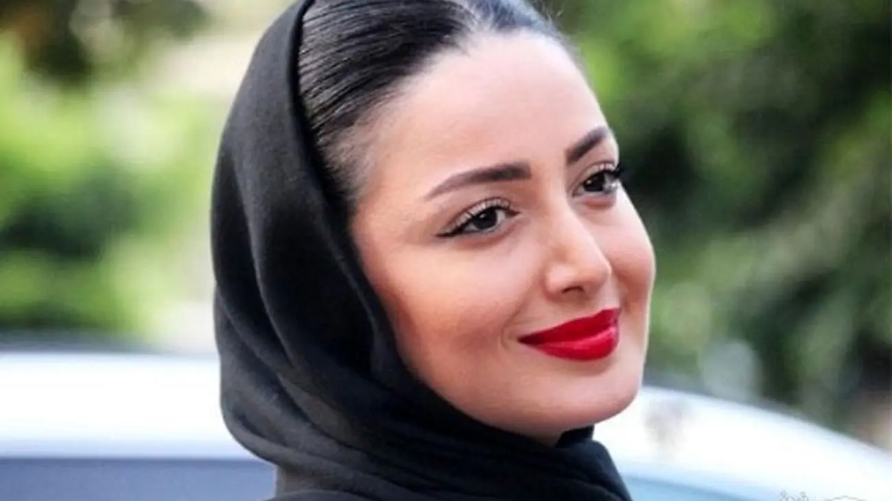 عکس قبل از عمل زیبایی شیلا خداداد / کوبید از نو ساخت !