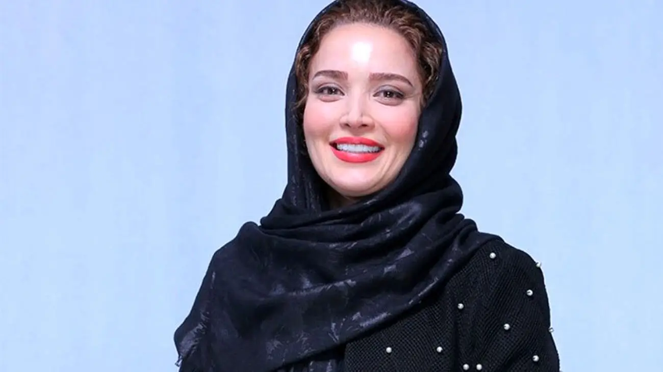 تغییر چهره شگفت انگیز بهنوش طباطبایی بعد از جراحی ! / باور کنید نمی شناسید !