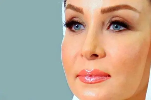 تغییر چهره حدیث فولادوند؛ بازیگری که دیگر شبیه گذشته‌اش نیست!