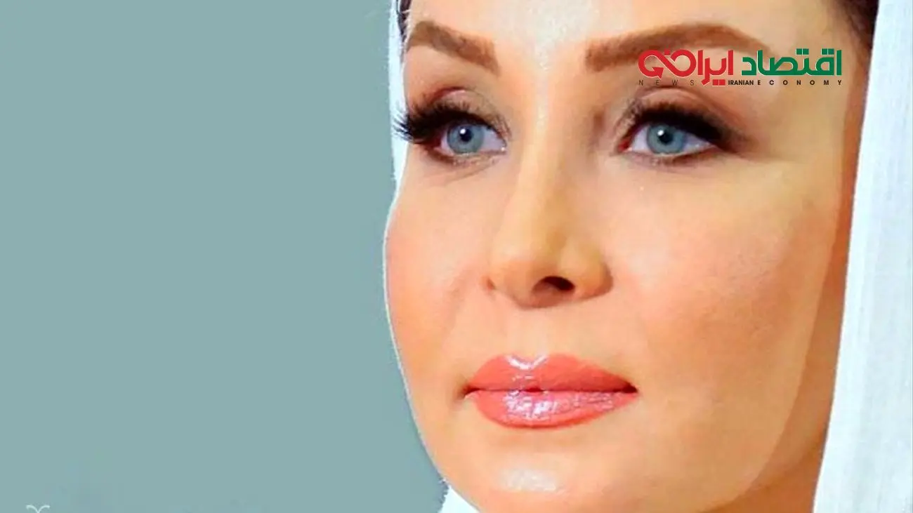 تغییر چهره حدیث فولادوند؛ بازیگری که دیگر شبیه گذشته‌اش نیست!