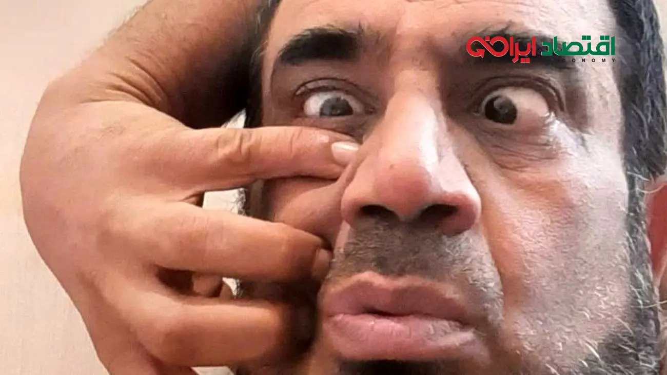 شوک بزرگ به طرفداران نصرالله رادش؛ تغییر چهره آن‌هم در سن ۵۹ سالگی!