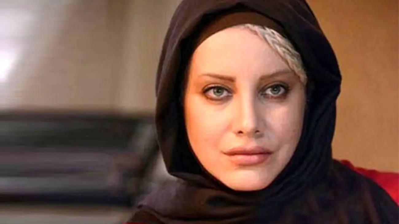 تغییرات فاحش شراره رخام قبل و بعد عمل زیبایی + عکس