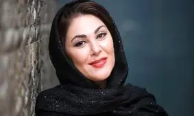 لاله اسکندری با تغییر چهره همه را شگفت زده کرد؛ از بازیگری تا زندگی روستایی!